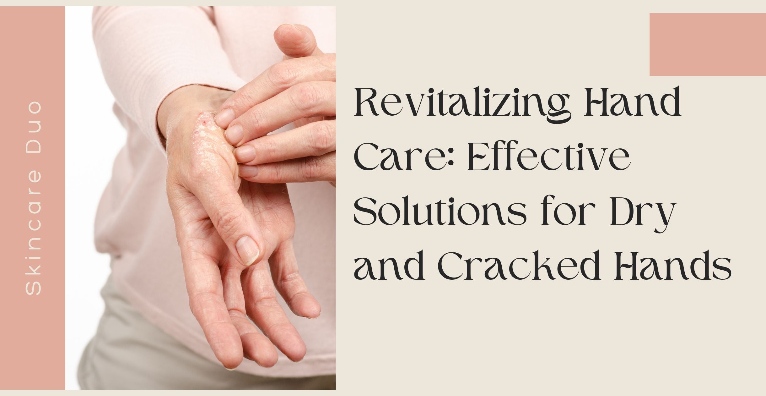 Revitalizing Hand Care: Effective Solutions for Dry and Cracked Hands