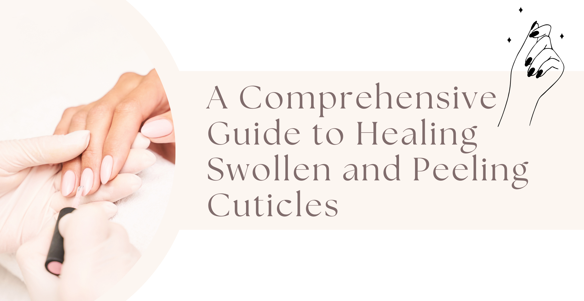 Reviving Your Nails: A Comprehensive Guide to Healing Swollen and Peeling Cuticles