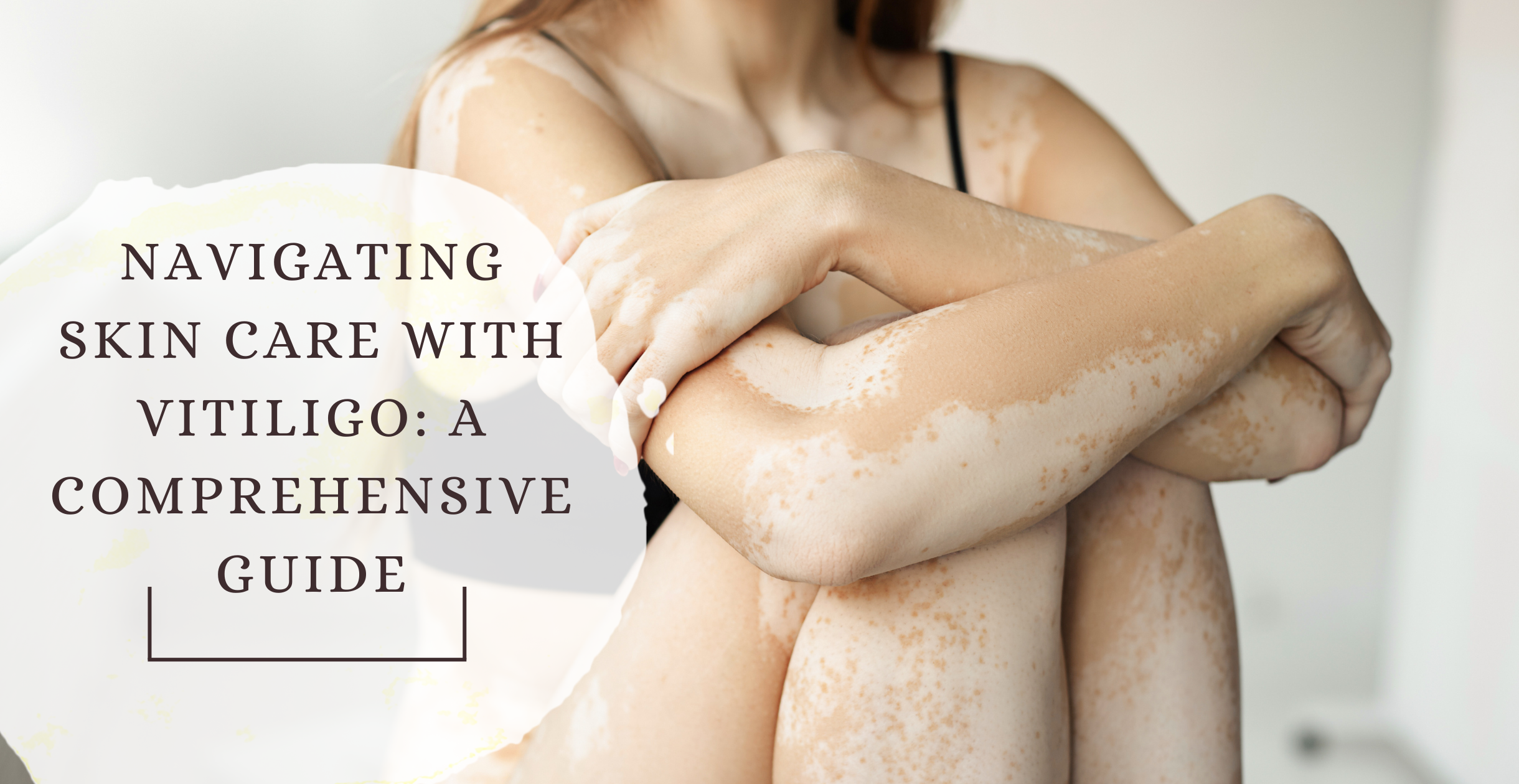 Navigating Skin Care with Vitiligo: A Comprehensive Guide