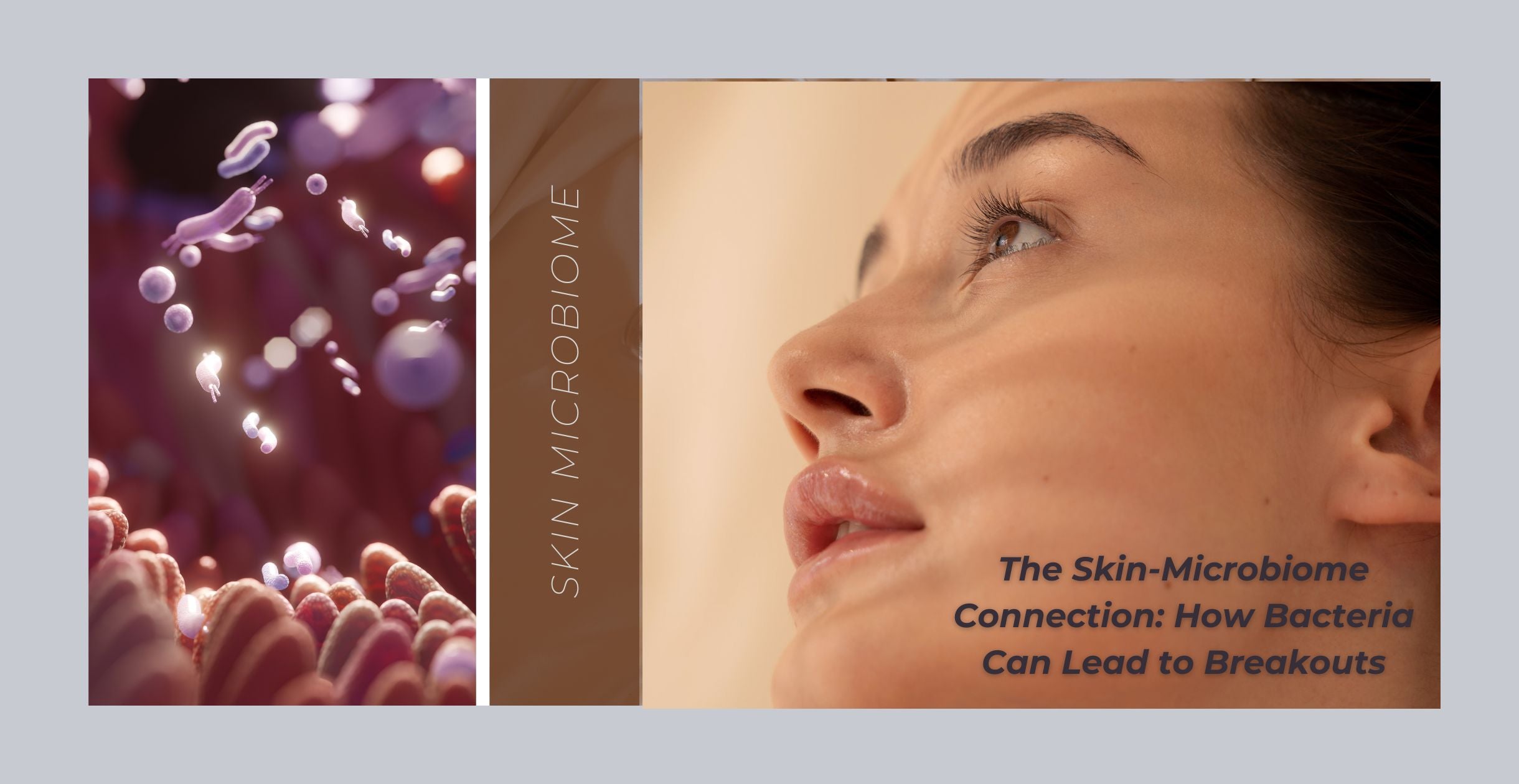 The Skin-Microbiome Connection: How Bacteria Can Lead to Breakouts