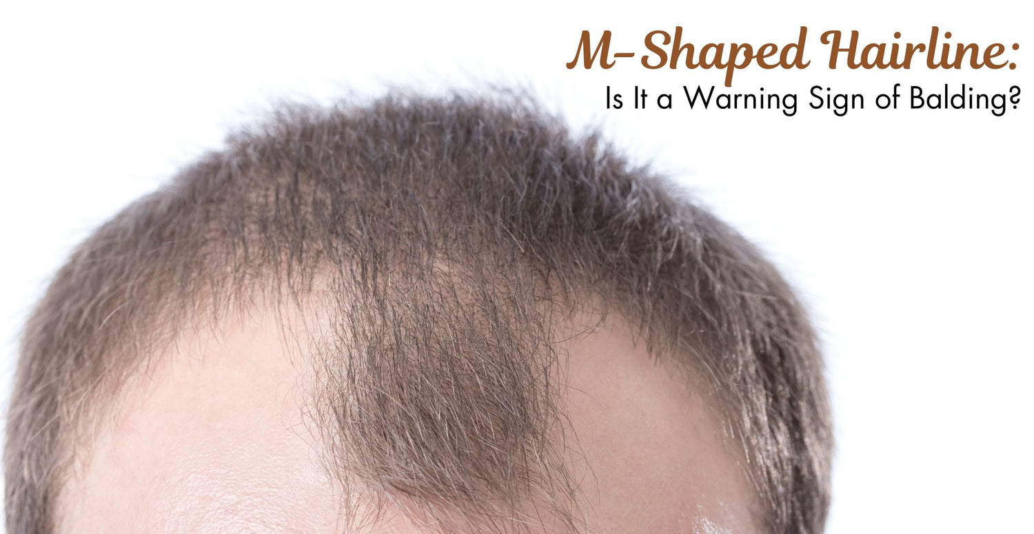 M-Shaped Hairline: Is It a Warning Sign of Balding?