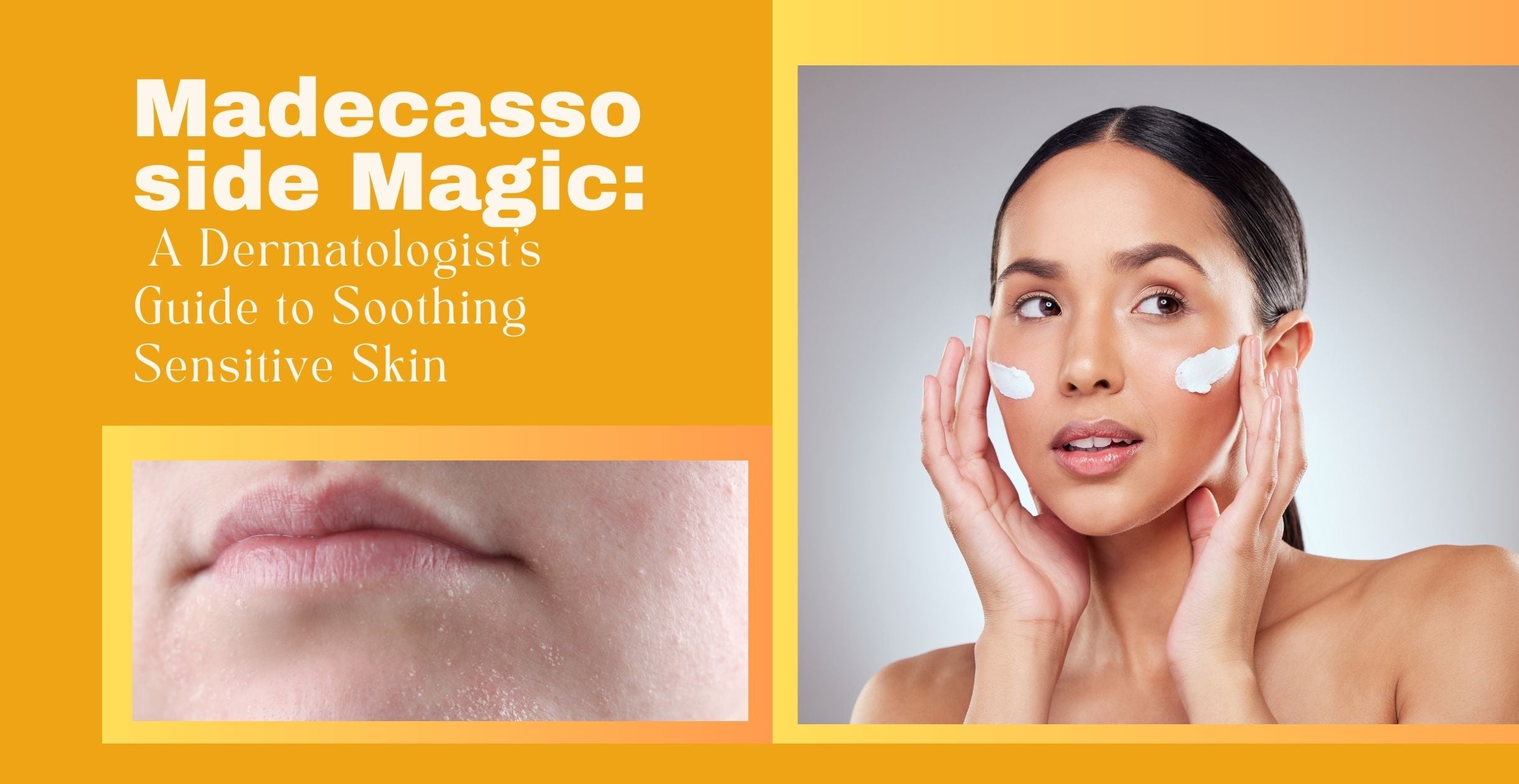 Madecassoside Magic: A Dermatologist’s Guide to Soothing Sensitive Skin