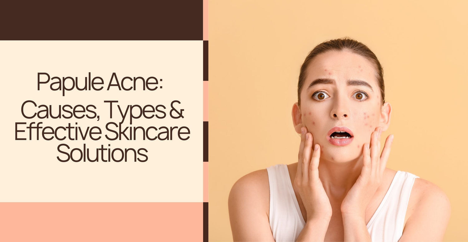 Papule Acne: Causes, Types & Effective Skincare Solutions