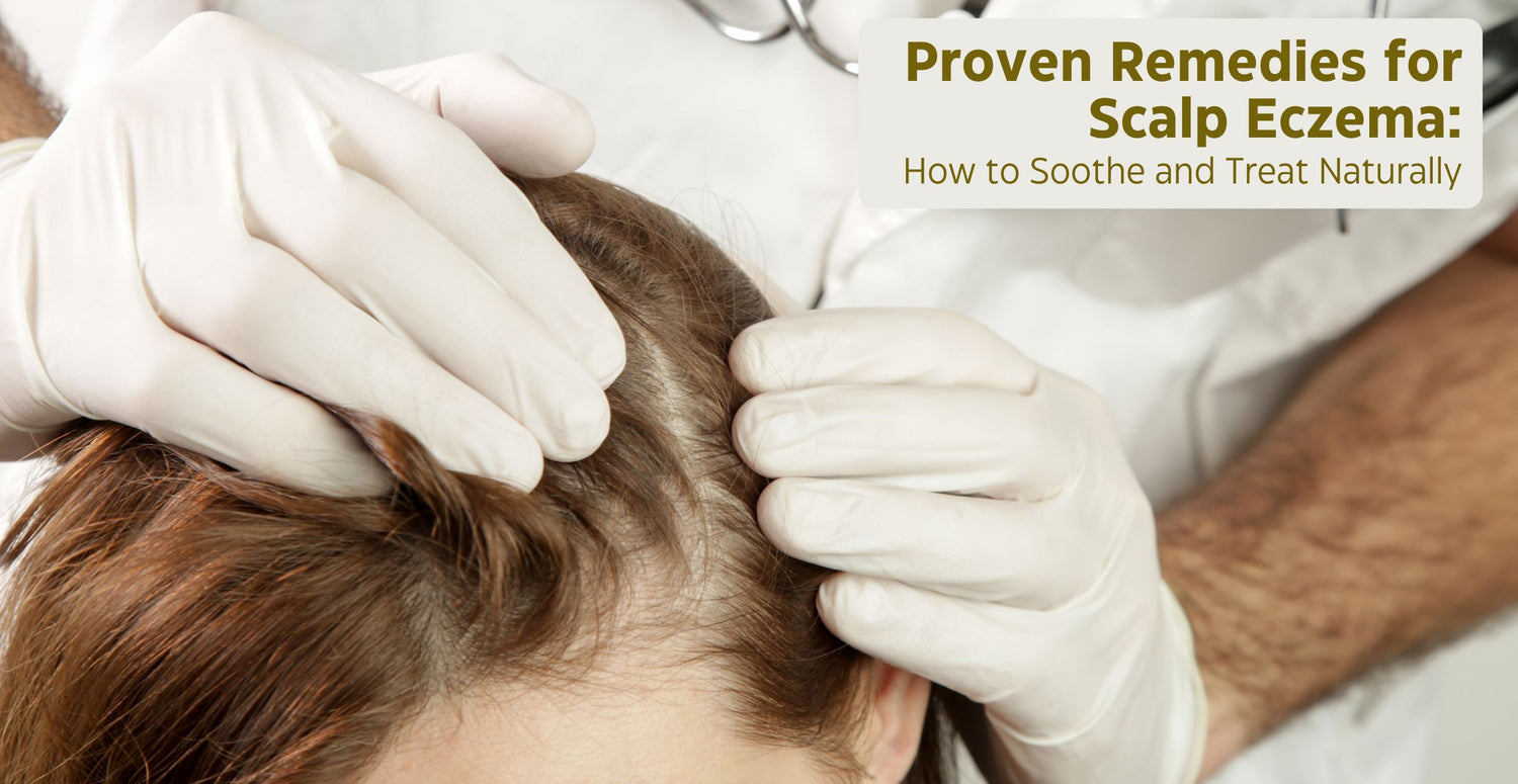 Proven Remedies for Scalp Eczema: How to Soothe and Treat Naturally