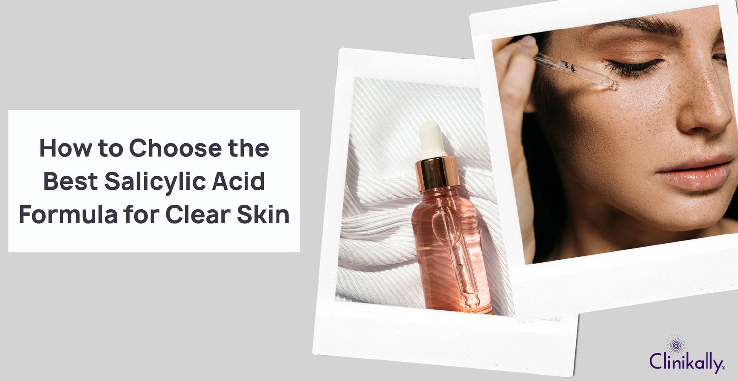 How to Choose the Best Salicylic Acid Formula for Clear Skin