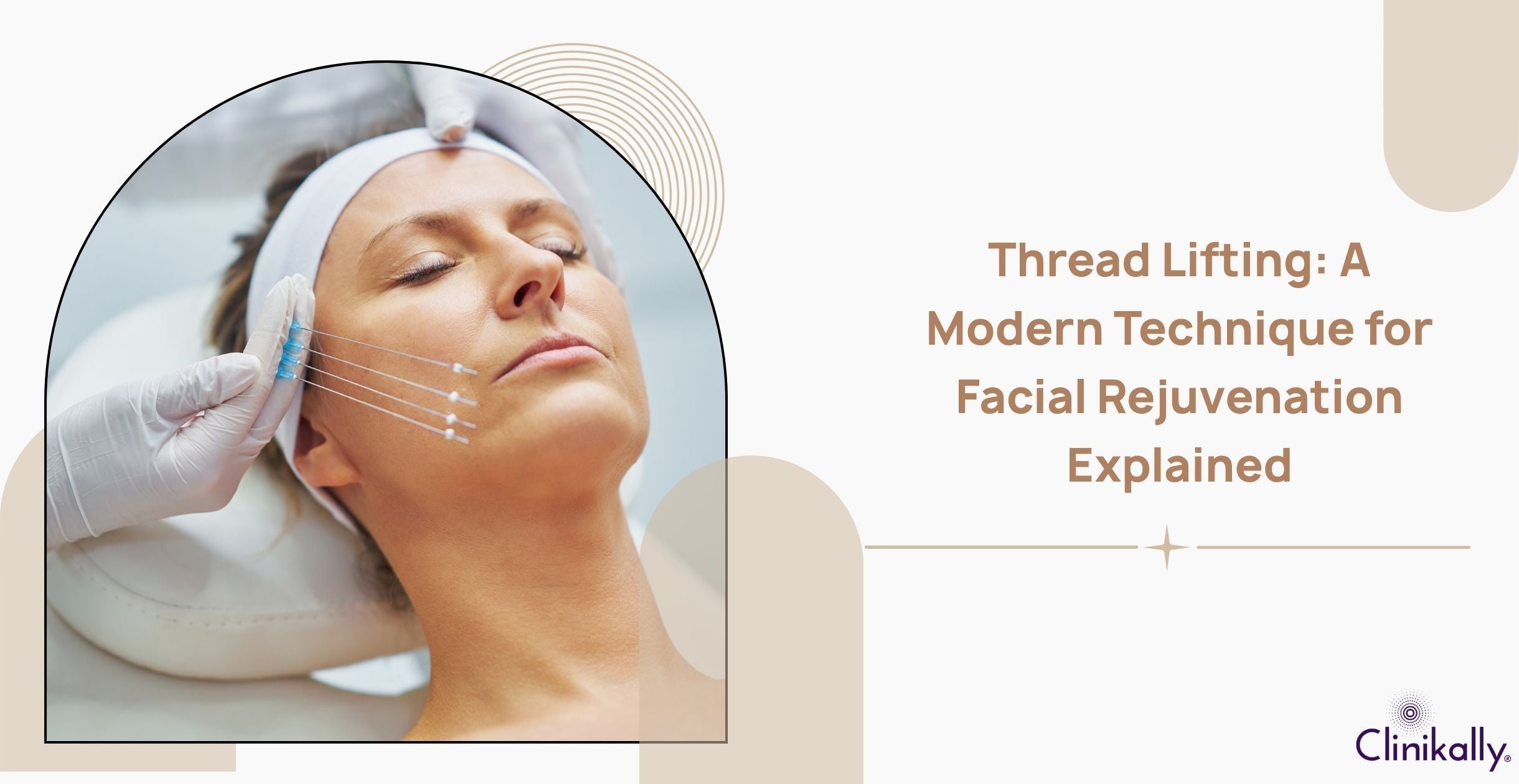 Thread Lifting: A Modern Way to Rejuvenate Your Face
