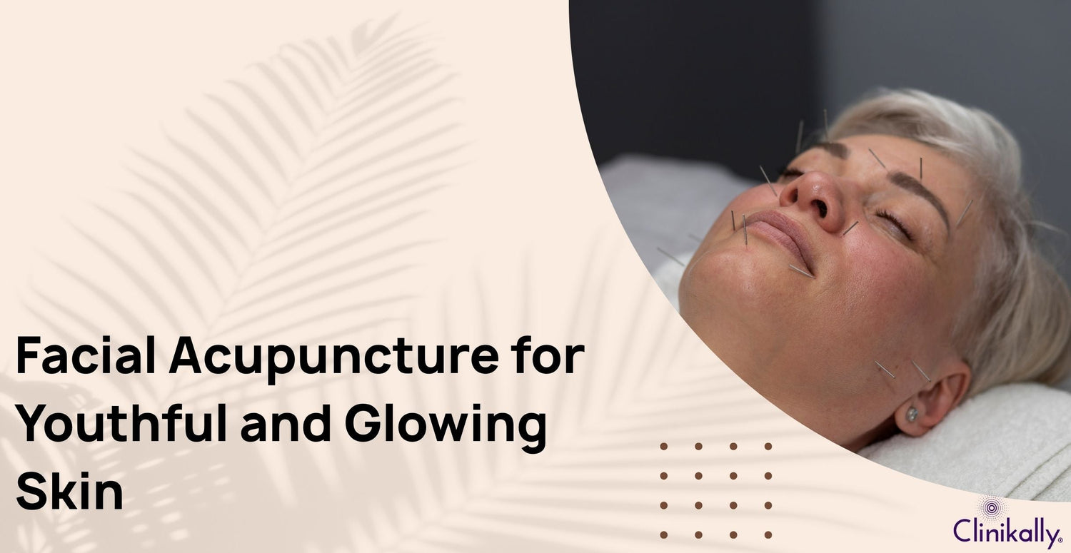  Facial Acupuncture for Youthful and Glowing Skin