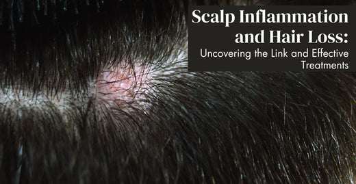 Scalp Inflammation and Hair Loss: Uncovering the Link and Effective Treatments