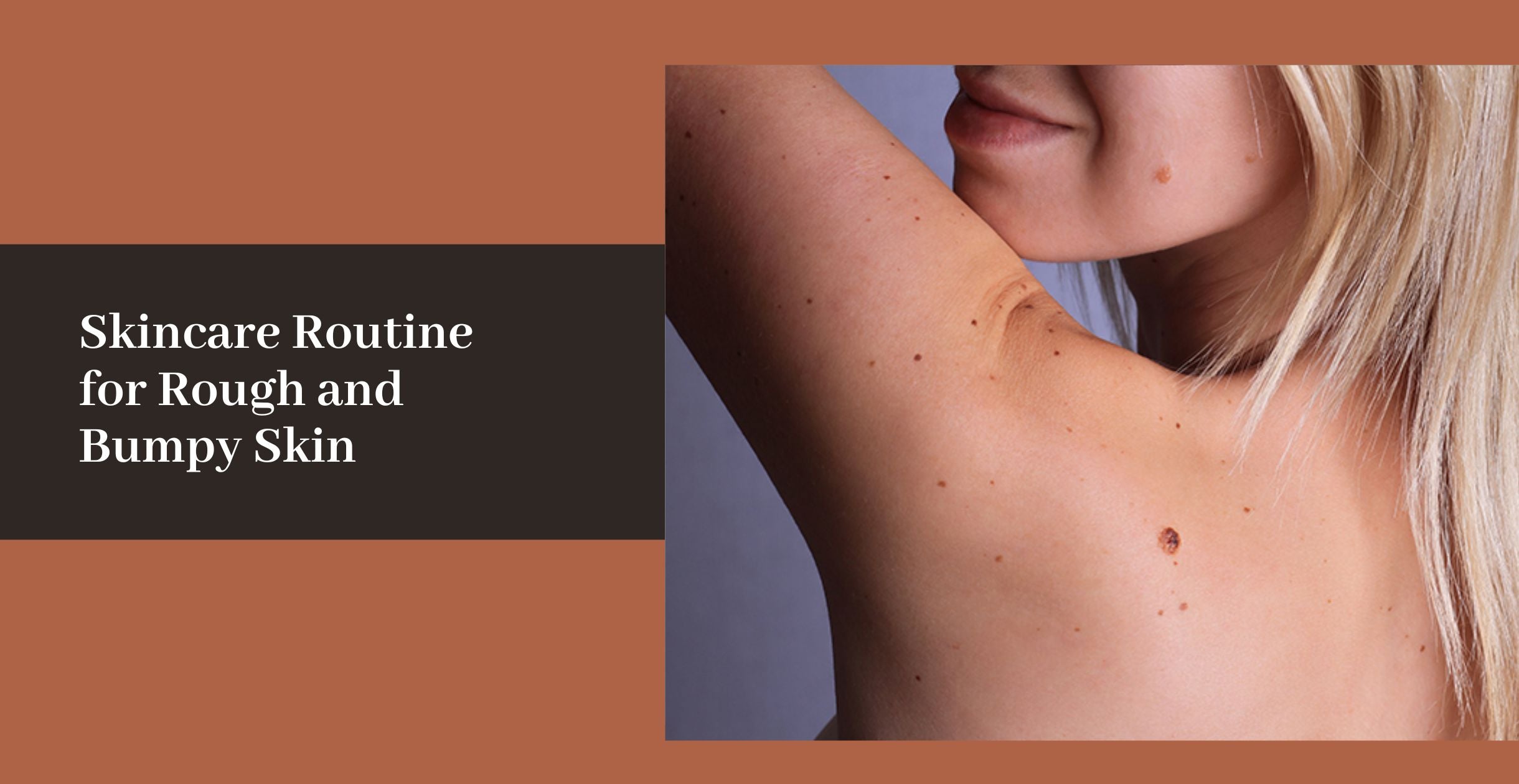 rough and bumpy skin 