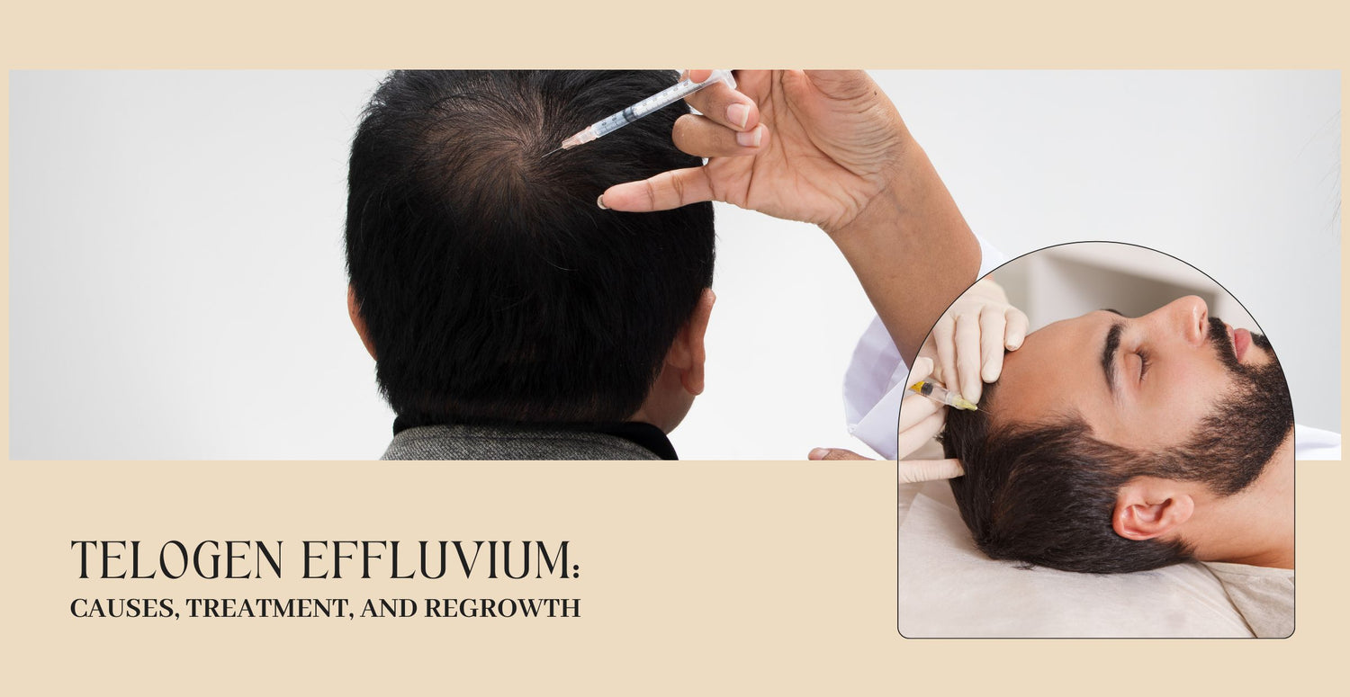 Telogen Effluvium: Causes, Treatment, and Regrowth
