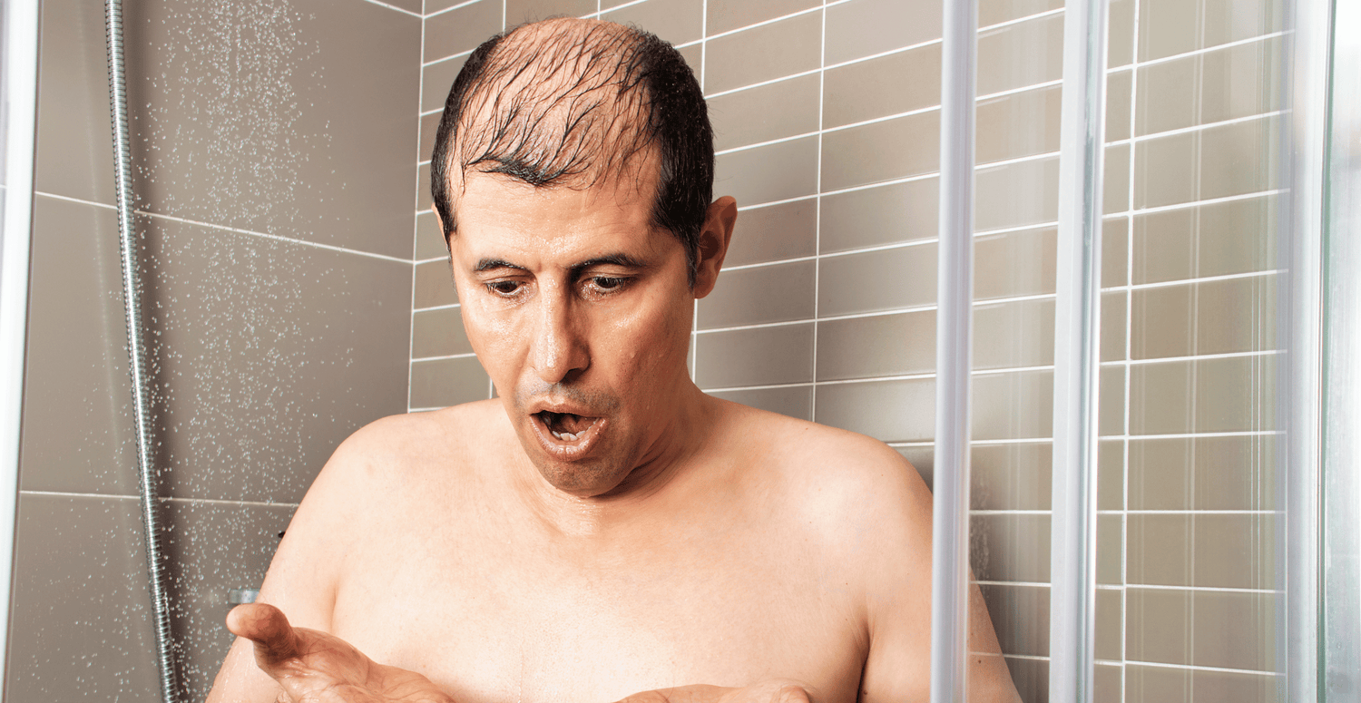 Preventing and Treating Hair Loss During COVID-19