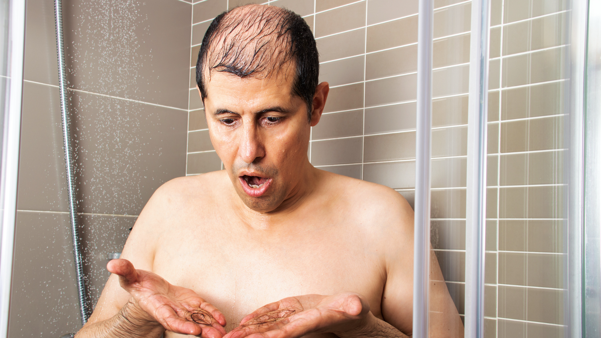 Topical Minoxidil for Hair Loss: Benefits, Side Effects, & How to Use 