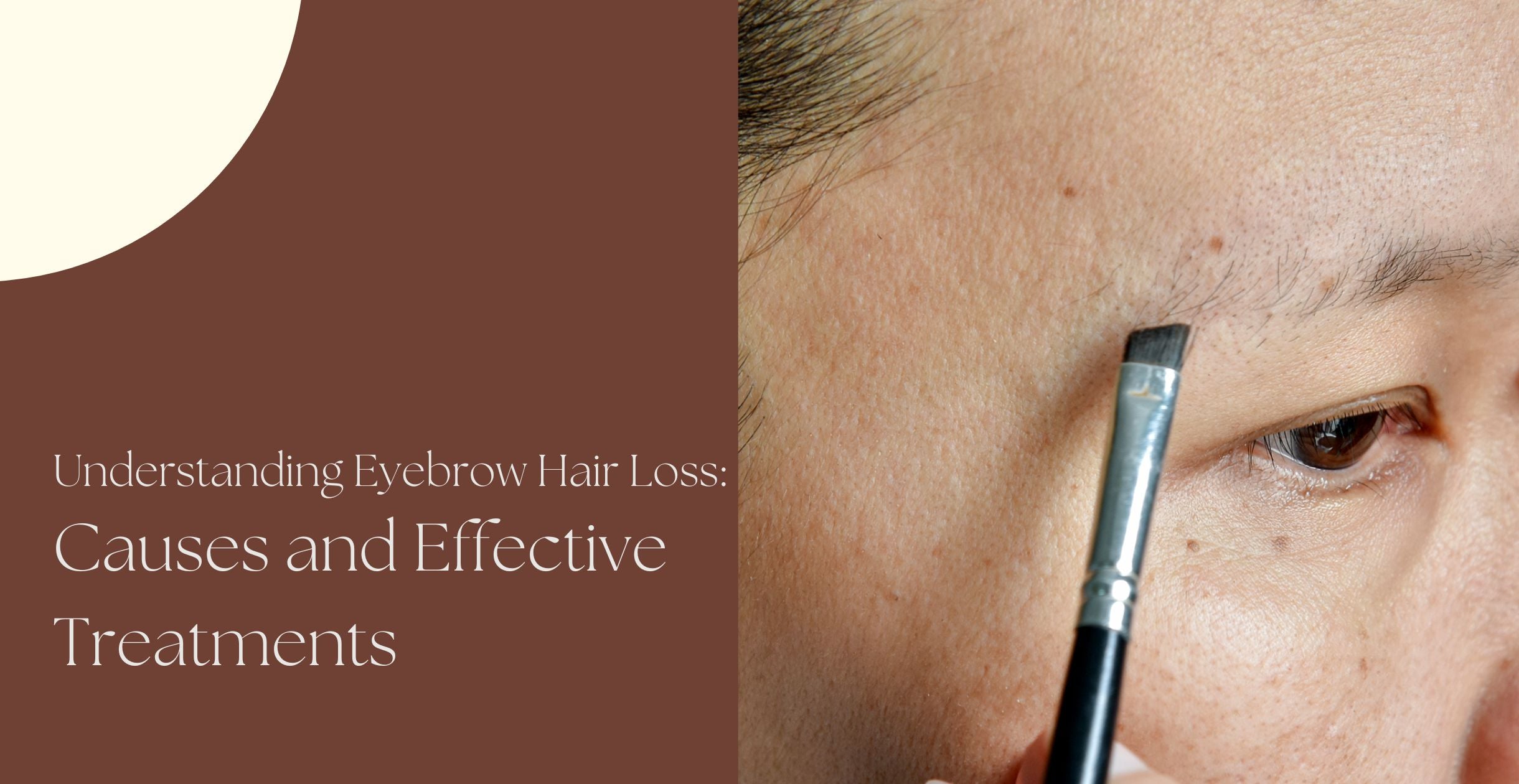 Understanding Eyebrow Hair Loss: Causes and Effective Treatments
