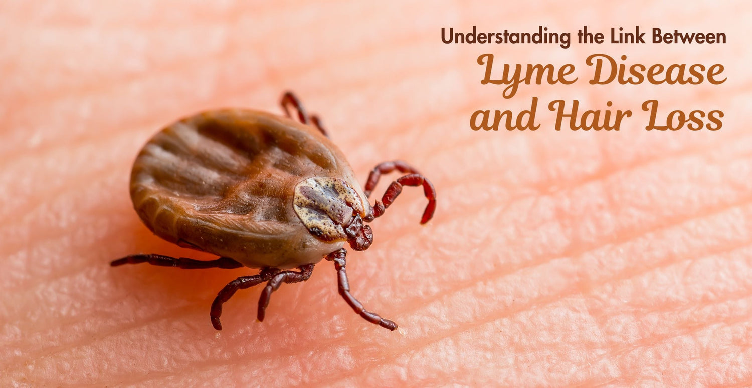 Understanding the Link Between Lyme Disease and Hair Loss