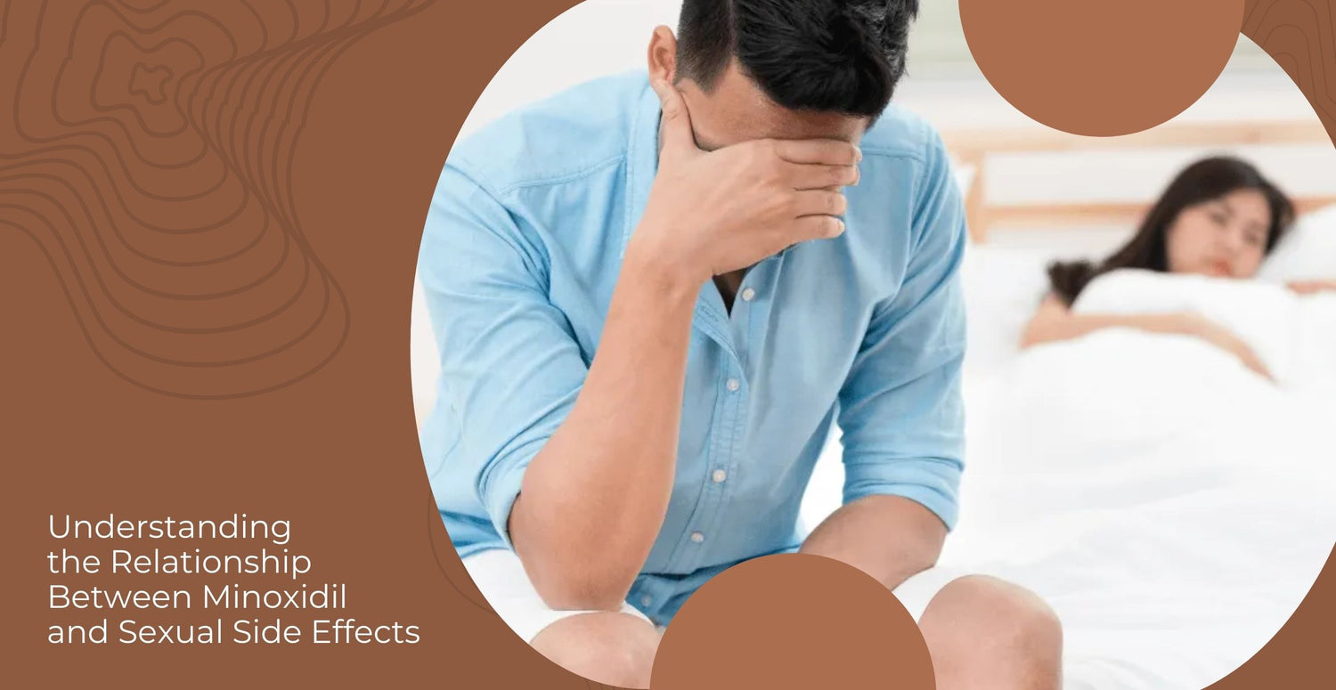 Understanding the Relationship Between Minoxidil and Sexual Side Effects