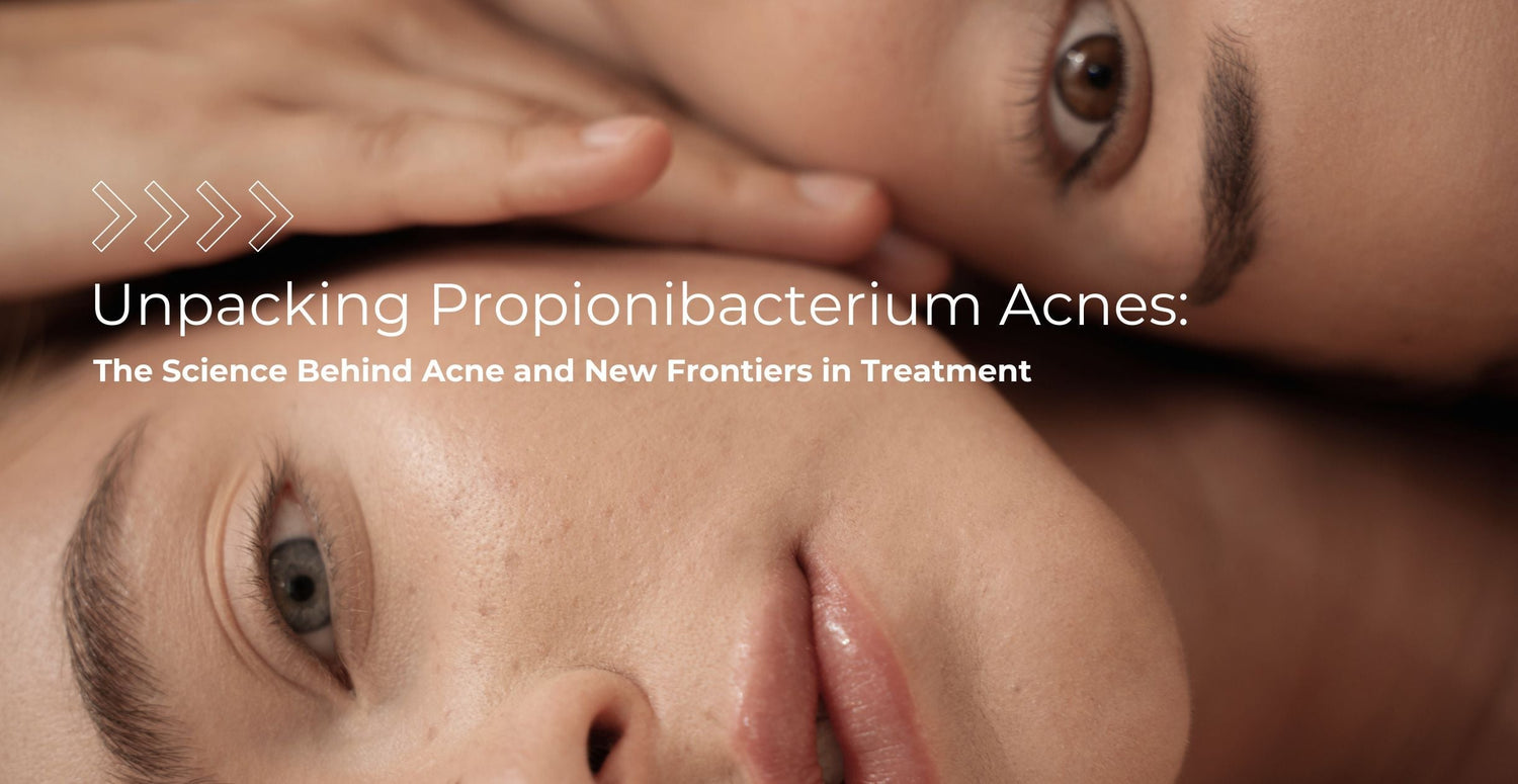 Unpacking Propionibacterium acnes: The Science Behind Acne and New Frontiers in Treatment