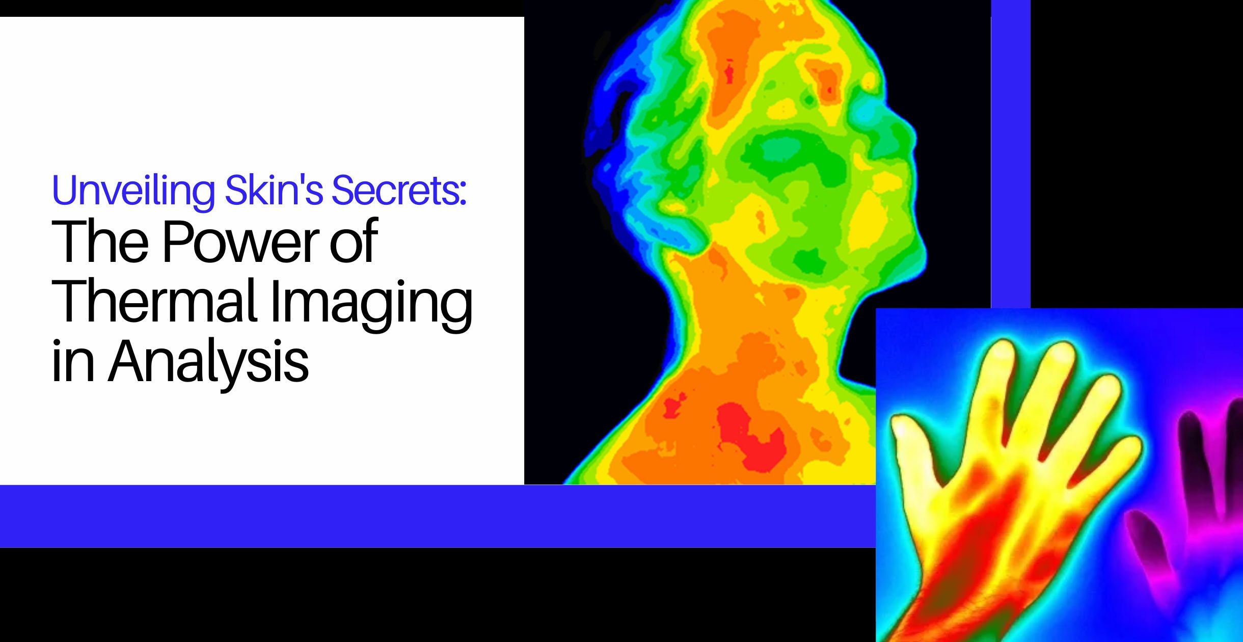 Unveiling Skin's Secrets: The Power of Thermal Imaging in Analysis