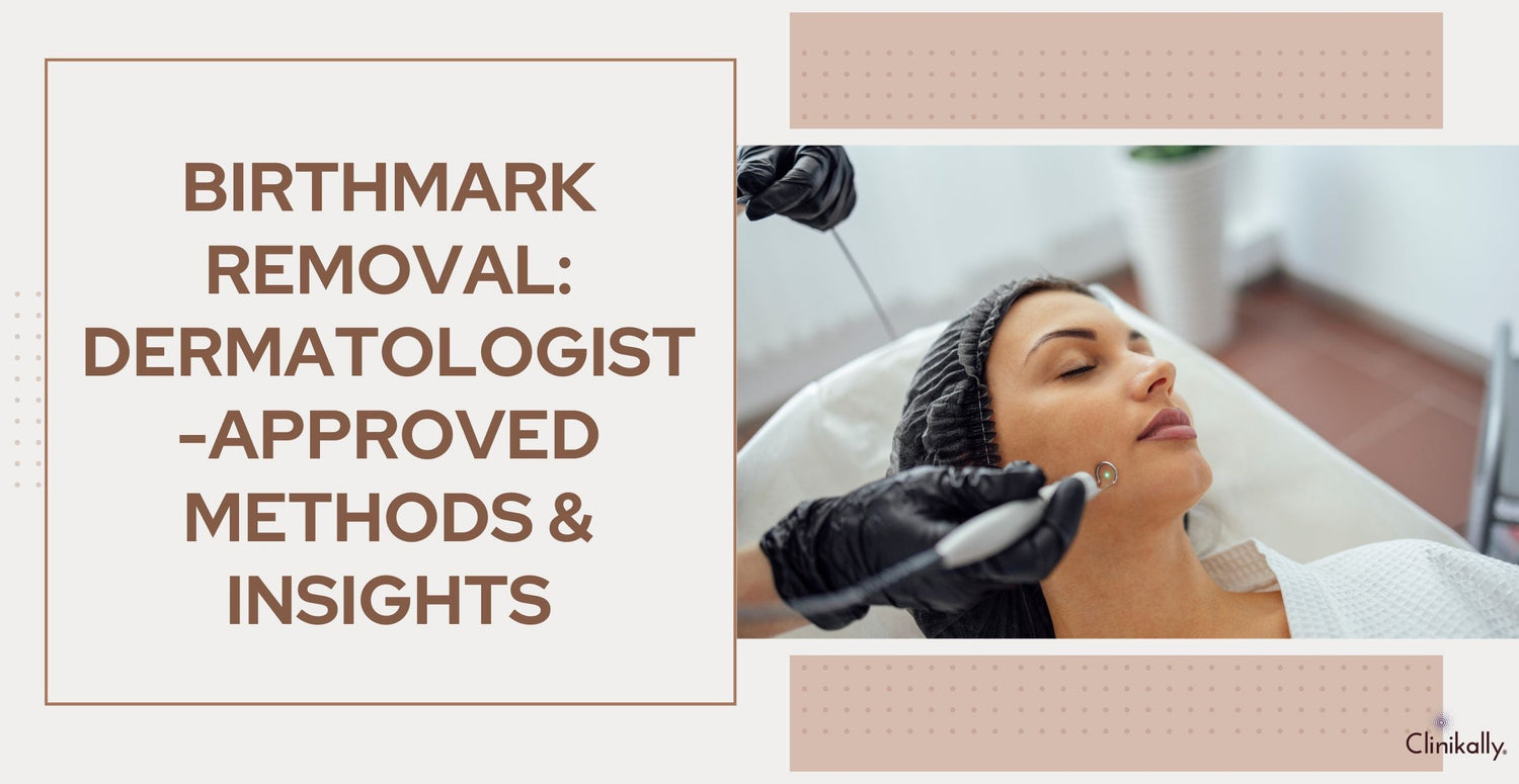 Birthmark Removal: Dermatologist-Approved Methods & Insights