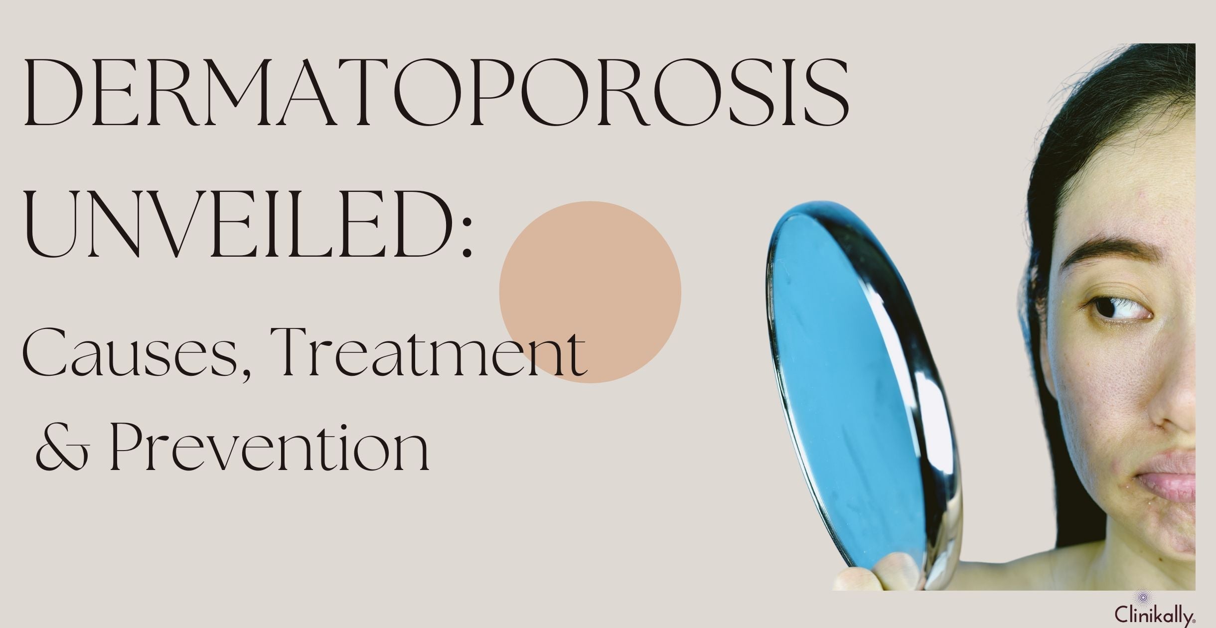 Dermatoporosis Unveiled: Causes, Treatment & Prevention