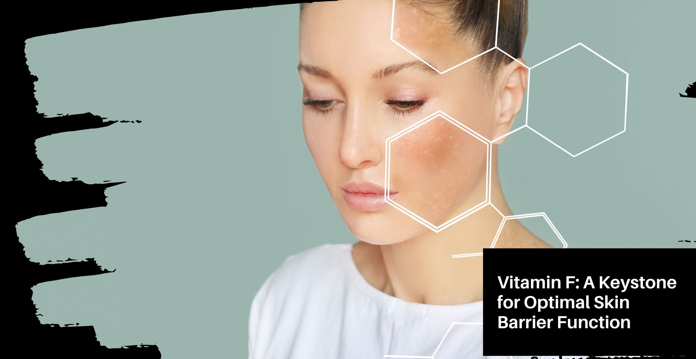 Vitamin F: A Keystone for Optimal Skin Barrier Function