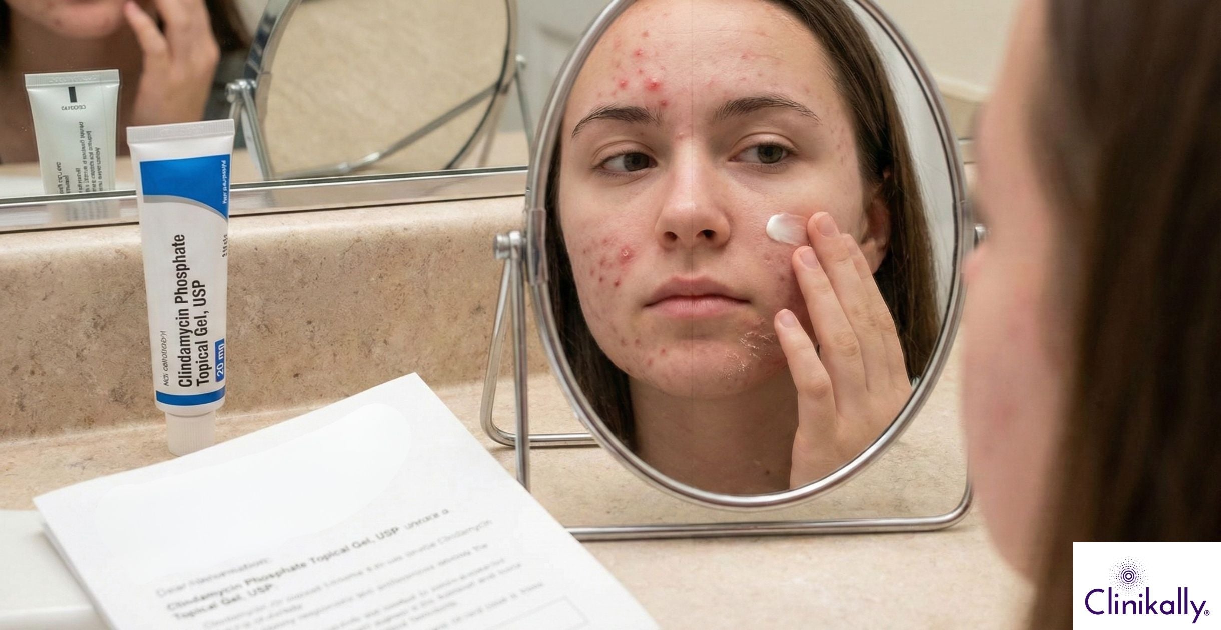 Woman applying cream on acne while looking in mirror