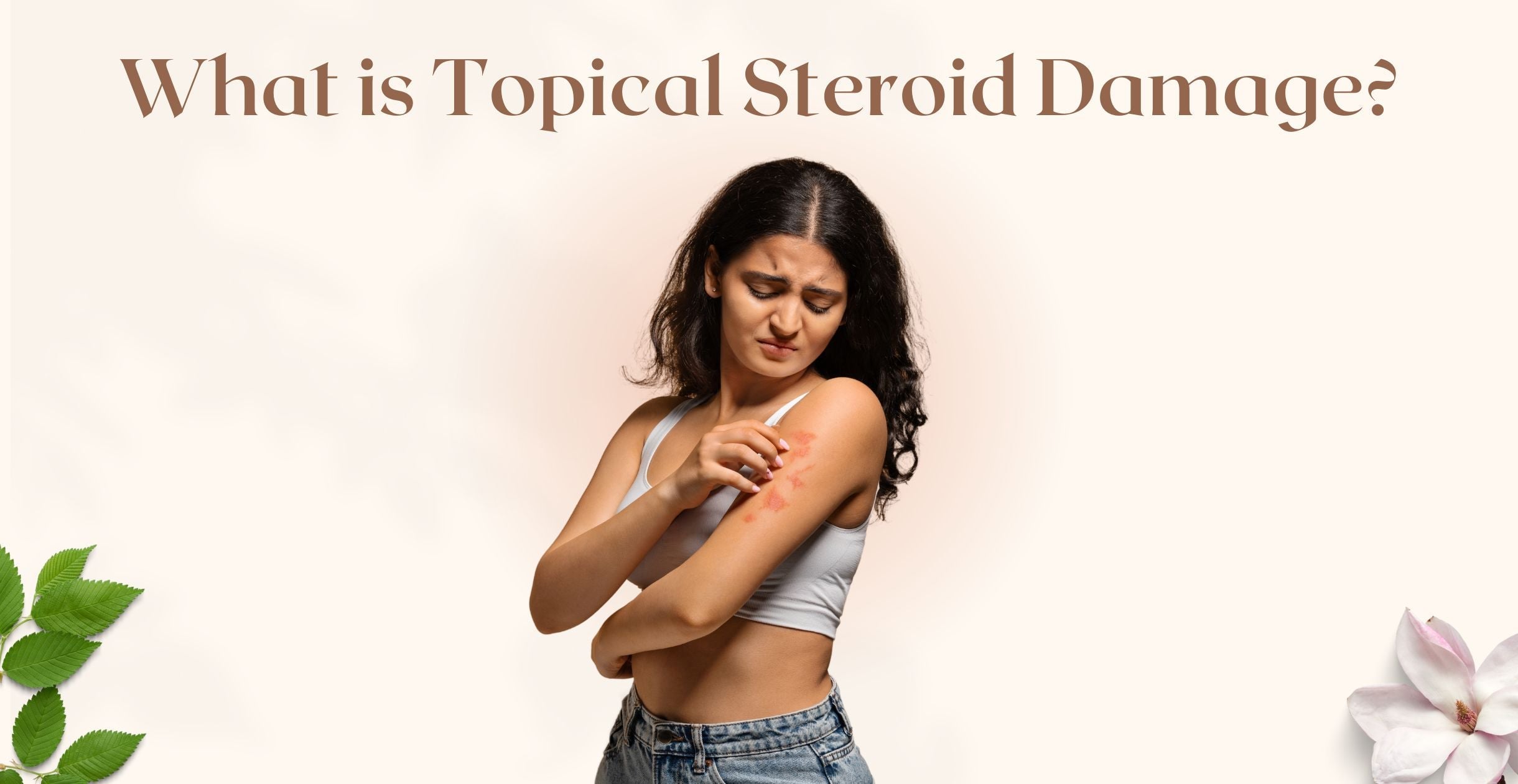 What is Topical Steroid Damage?