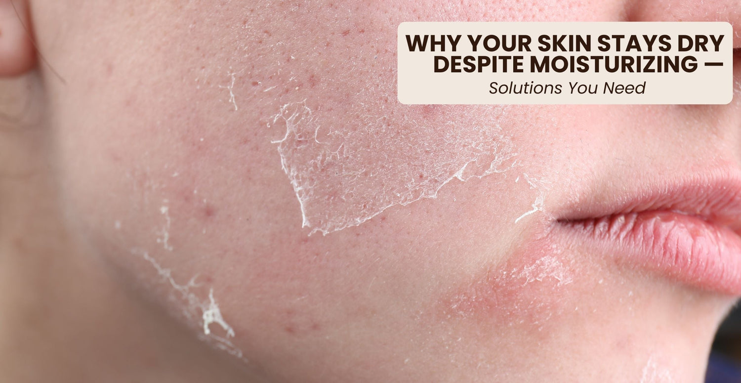 Why Your Skin Stays Dry Despite Moisturizing — Solutions You Need