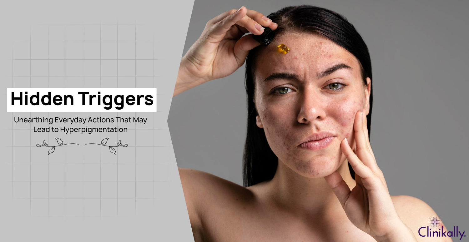 Hidden Triggers: Unearthing Everyday Actions That May Lead to Hyperpigmentation