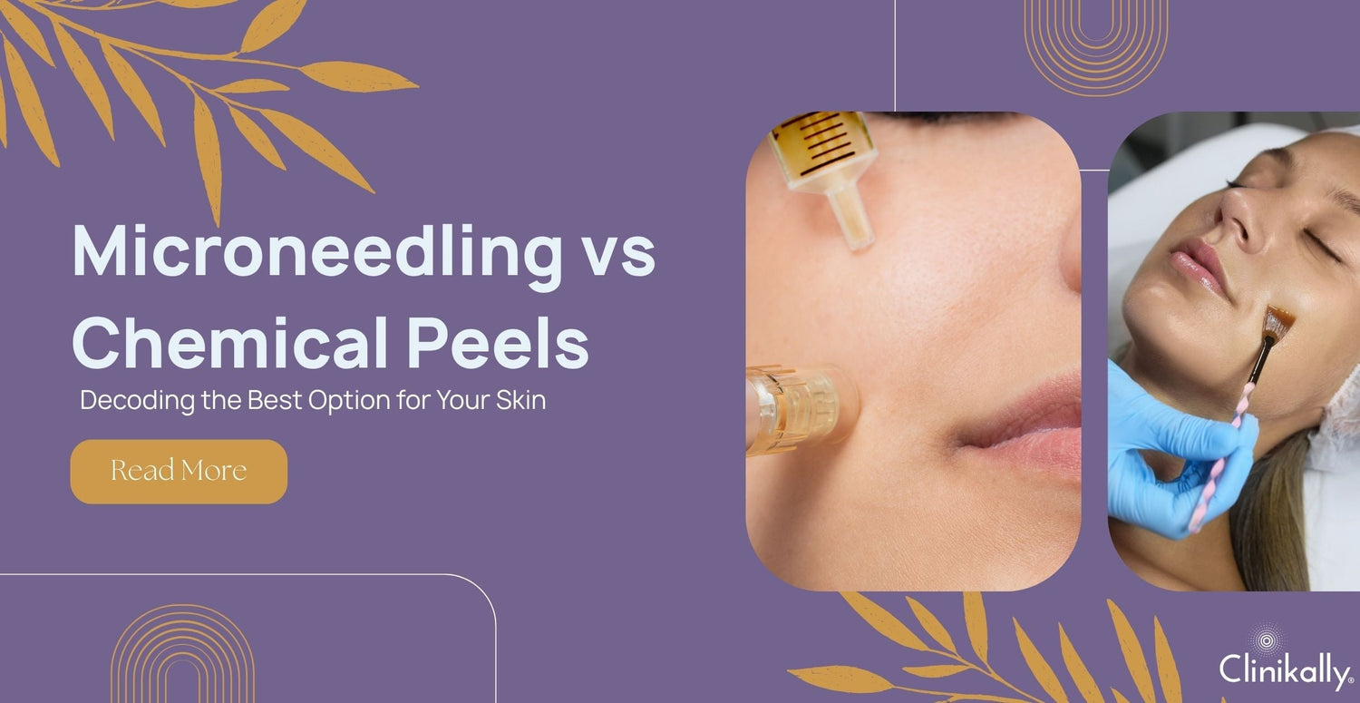 Microneedling vs Chemical Peels: Decoding the Best Option for Your Skin
