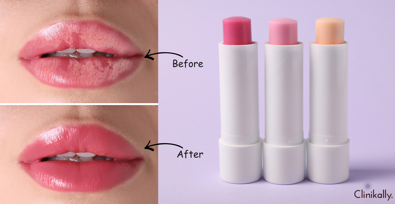 Ceramide Lip Care to Heal & Hydrate Dry Lips