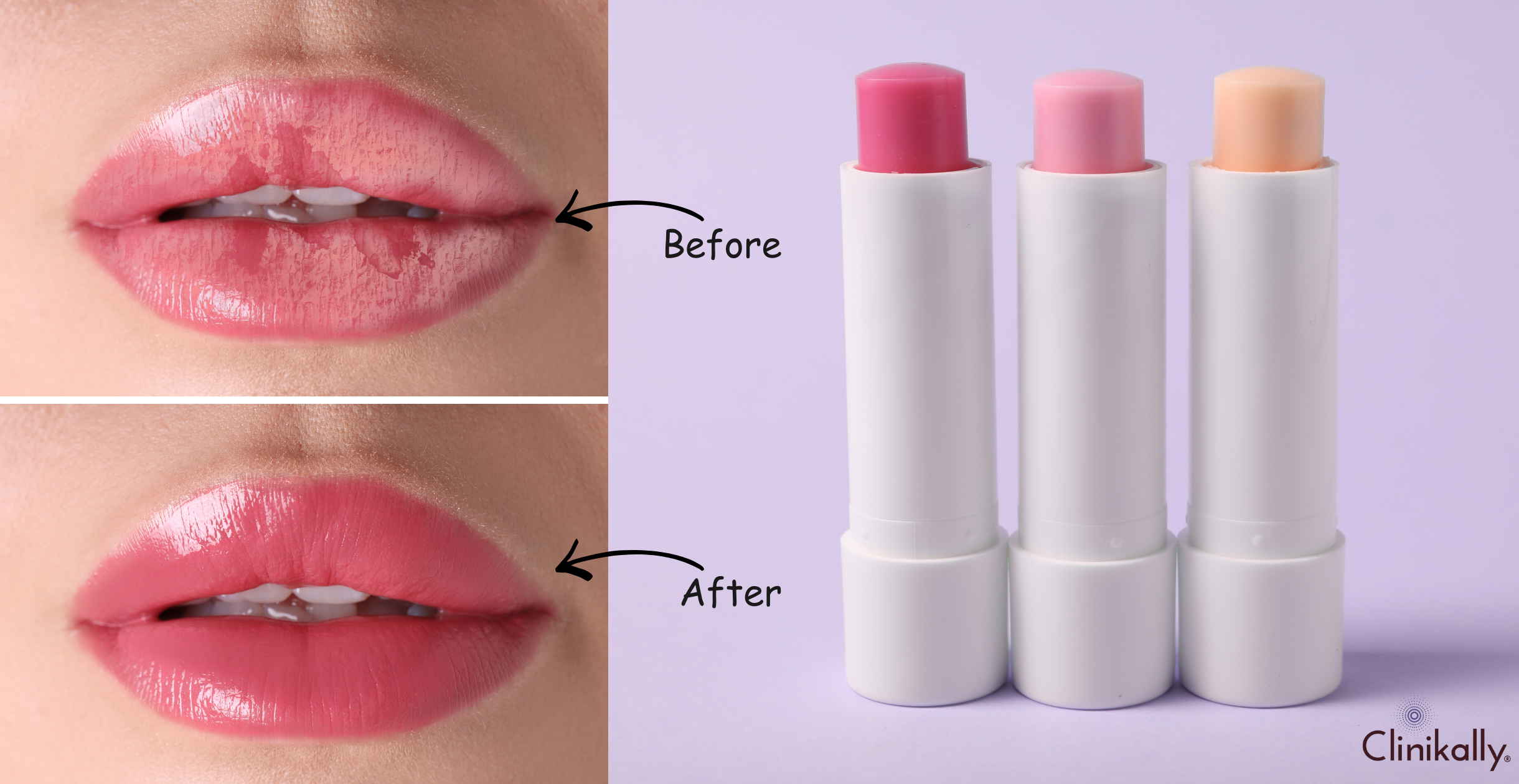Ceramide Lip Care to Heal & Hydrate Dry Lips