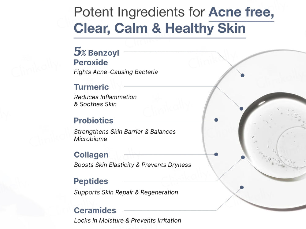 Wild Oak 5% Benzoyl Peroxide Acne Wash For Face & Body