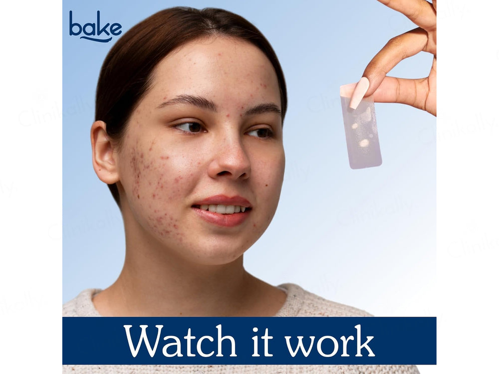 Bake 2% Salicylic Acid Acne Erase XL Patch