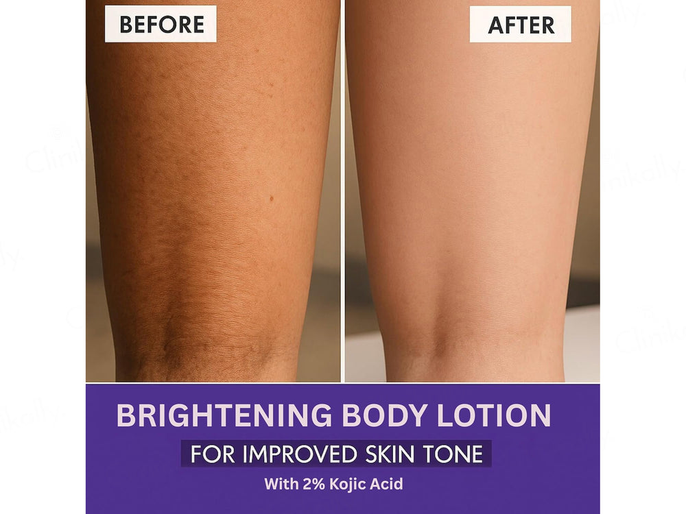Bake 2% Kojic Acid + Blueberry Daily Brightening Body Lotion SPF 30
