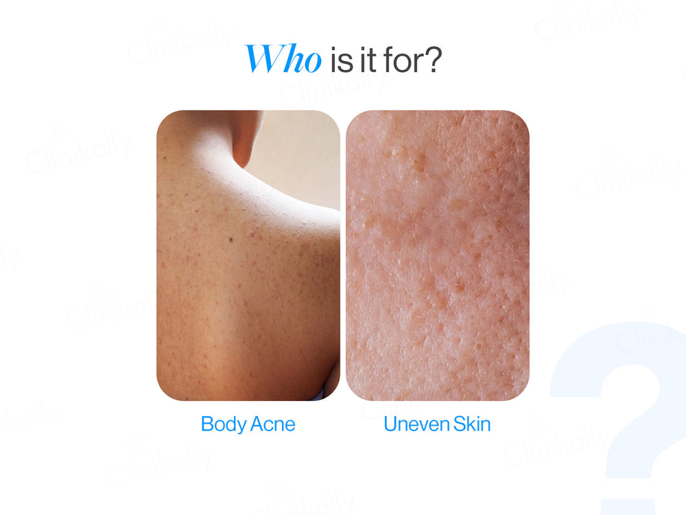 Be Bodywise 1% Salicylic Acid Body Wash