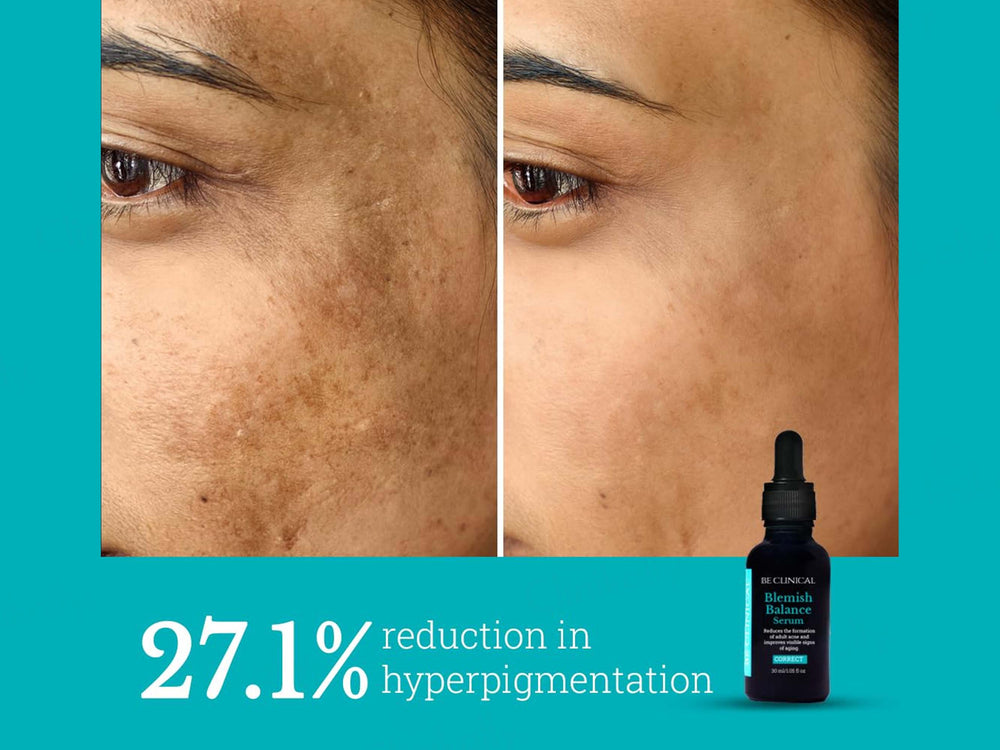 Be Clinical Blemish Balance Serum