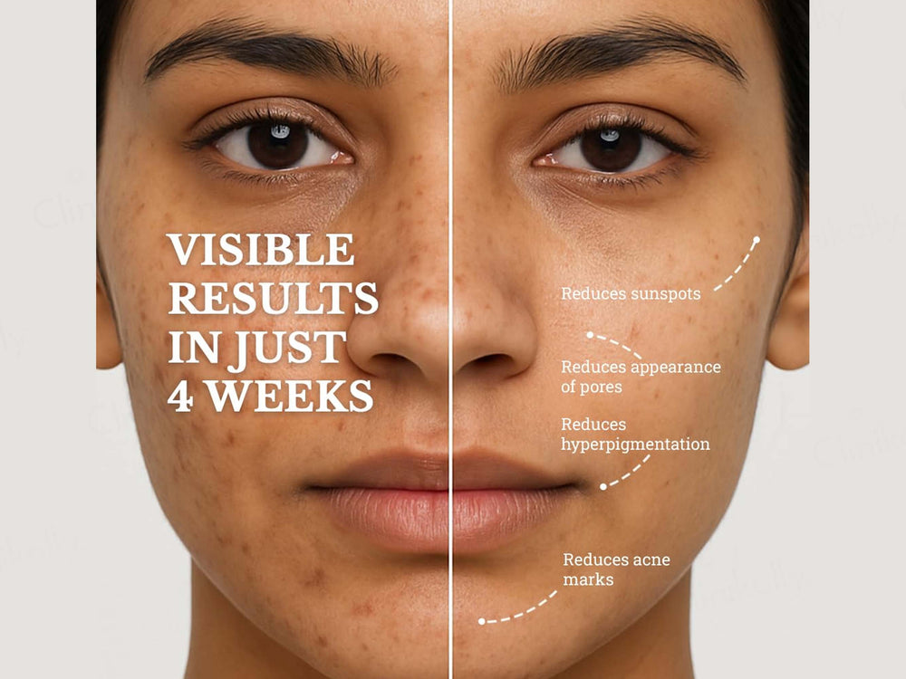 Be Clinical Blemish Balance Serum