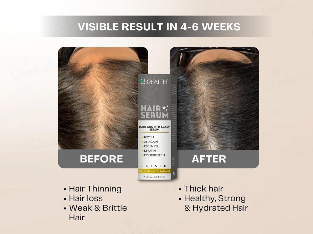 Biofaith Hair Regrowth Serum