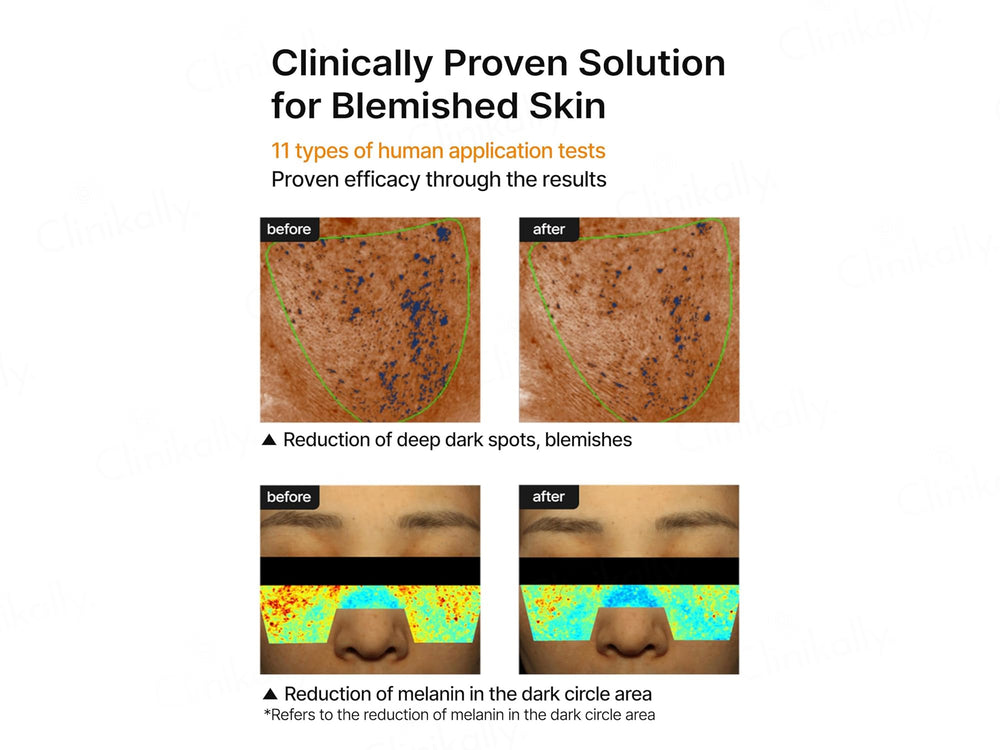 Celimax Pore + Dark Spot Brightening Cream