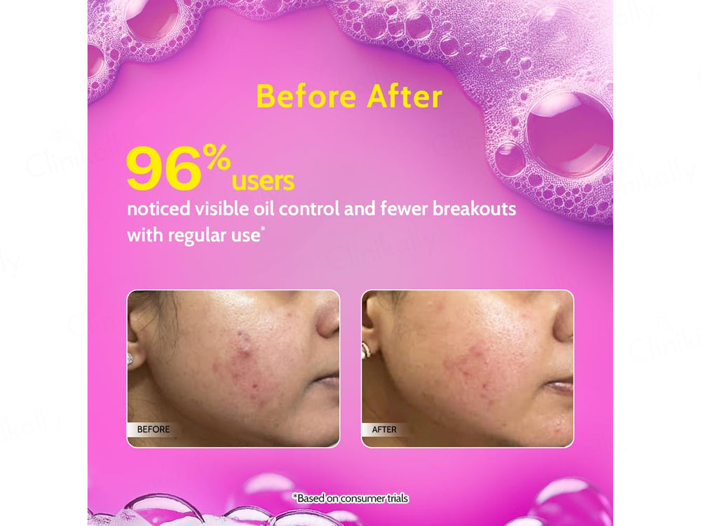 Chemist At Play 2% Salicylic Acid Oil & Acne Control Face Wash