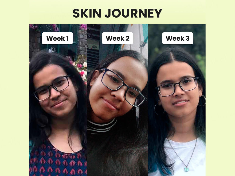 CosIQ Vitamin B3-10% Niacinamide Face Serum