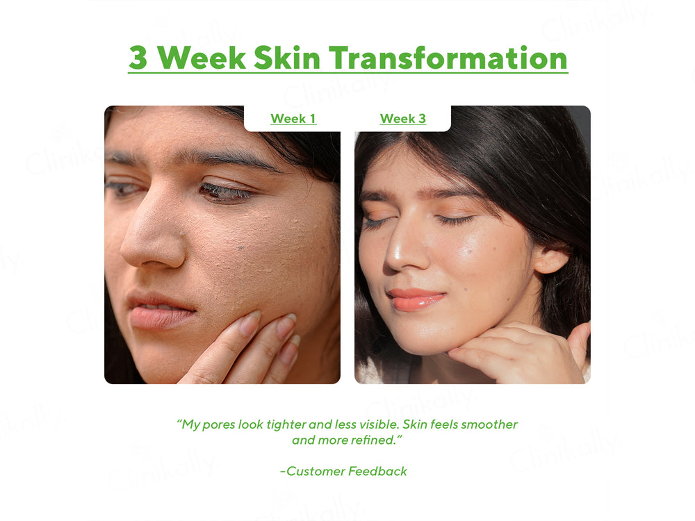 CosIQ Vitamin B3-5% Niacinamide Face Serum