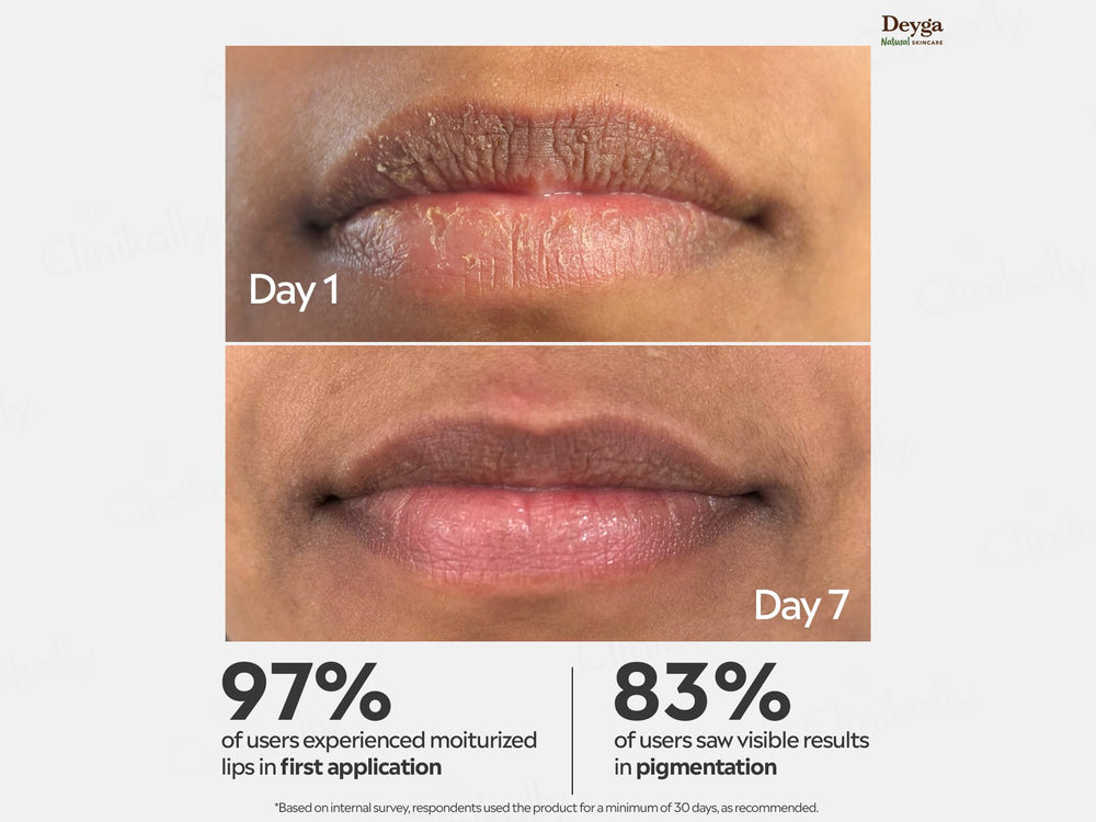 Deyga Beetroot Lip Balm