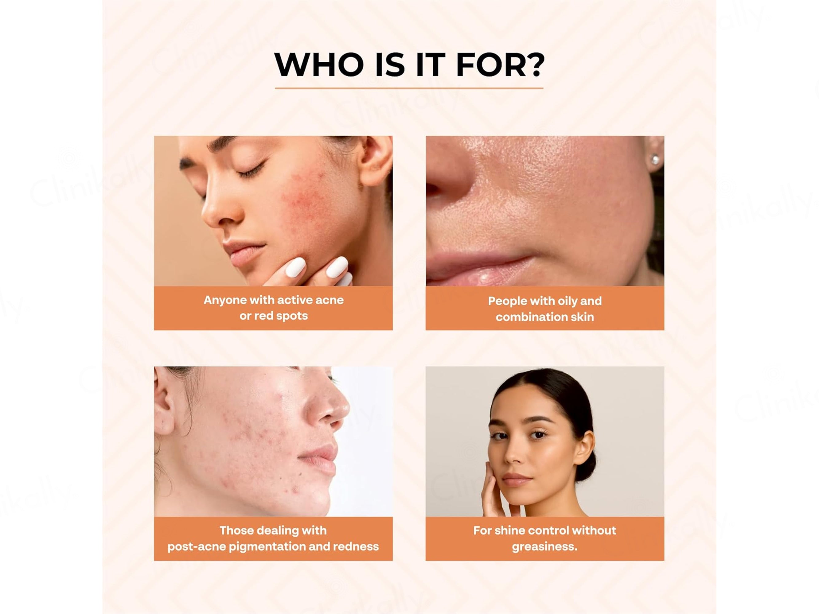 Dr. Sakhiya’s Acne & Pimple Morning Cream