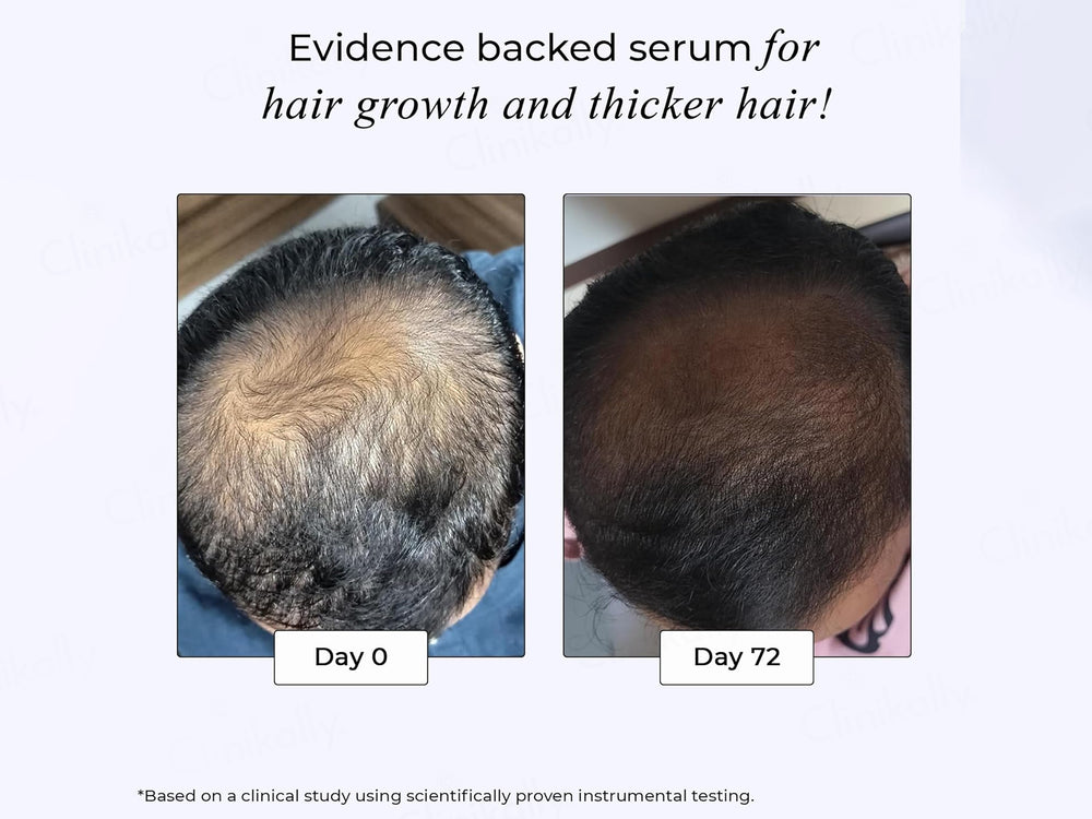 Dr. Su Revive Advanced Hair Growth Serum