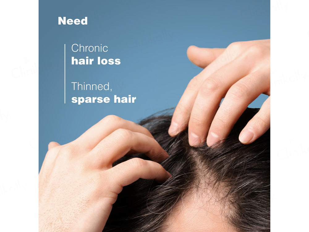 Ducray Anaphase Anti-Hair Loss Anti-Thinning Shampoo