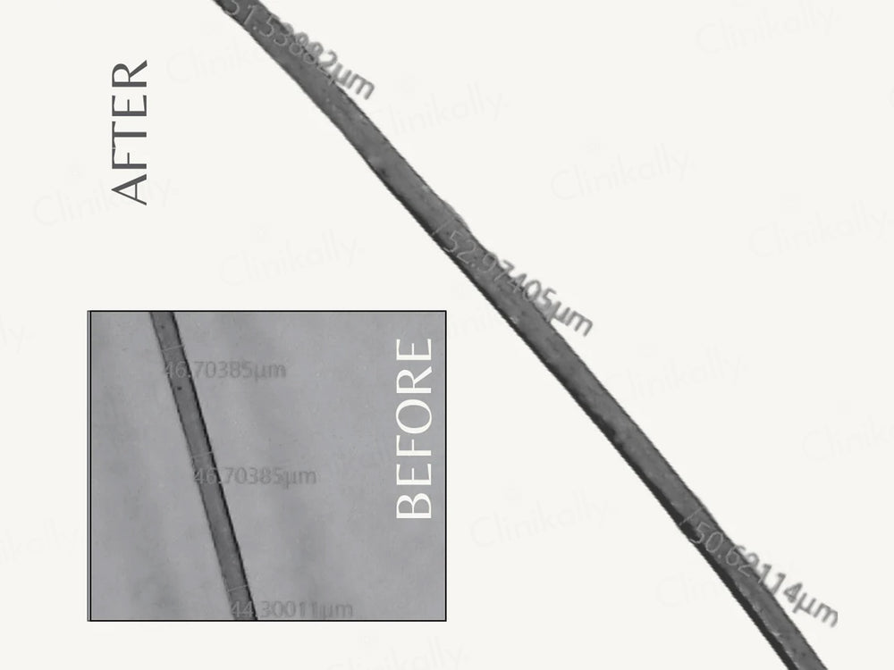 EnagenBio Komenuka Hair Strengthening Oil