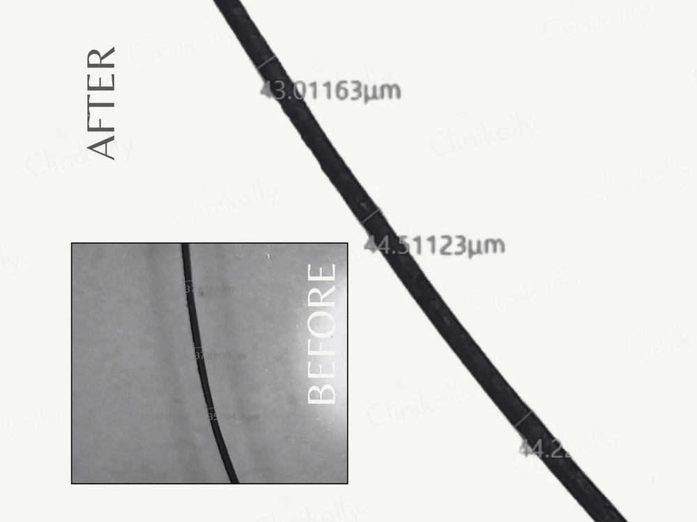 EnagenBio Komenuka Hair Strengthening Oil