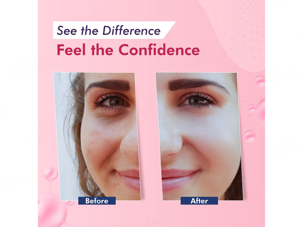 Enshiner Dark Spots Correcting Cream