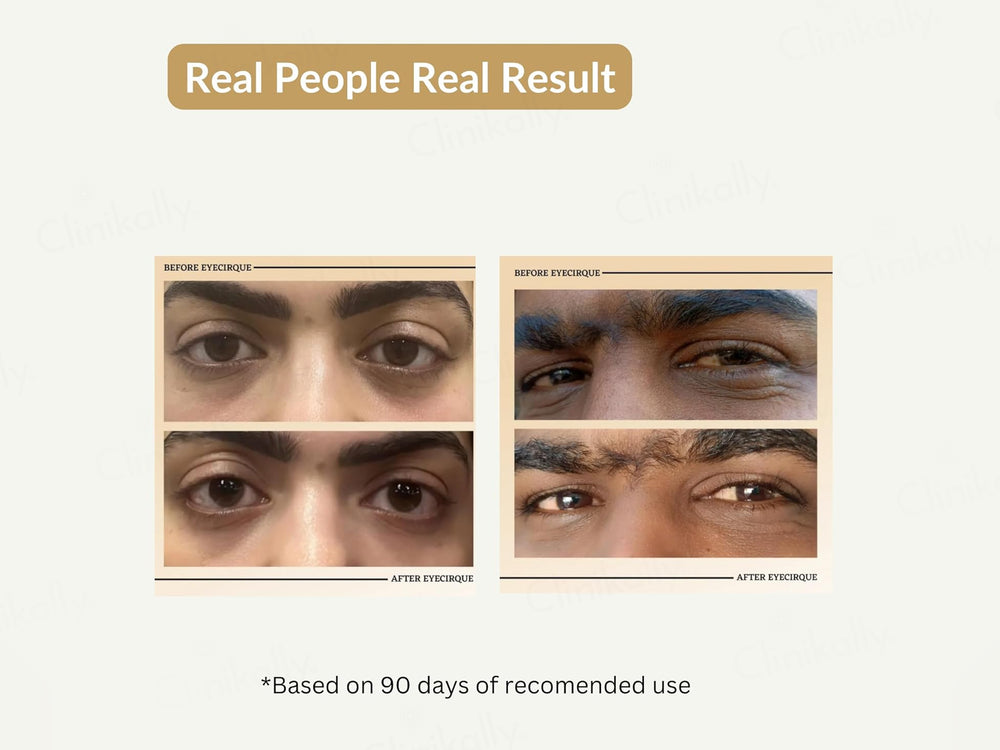 Eyecirque Coffee Under Eye Gel Serum